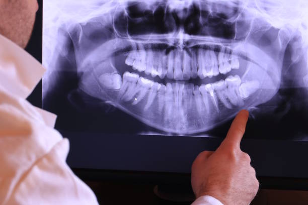 Best Emergency Denture Repair in Wautoma, WI